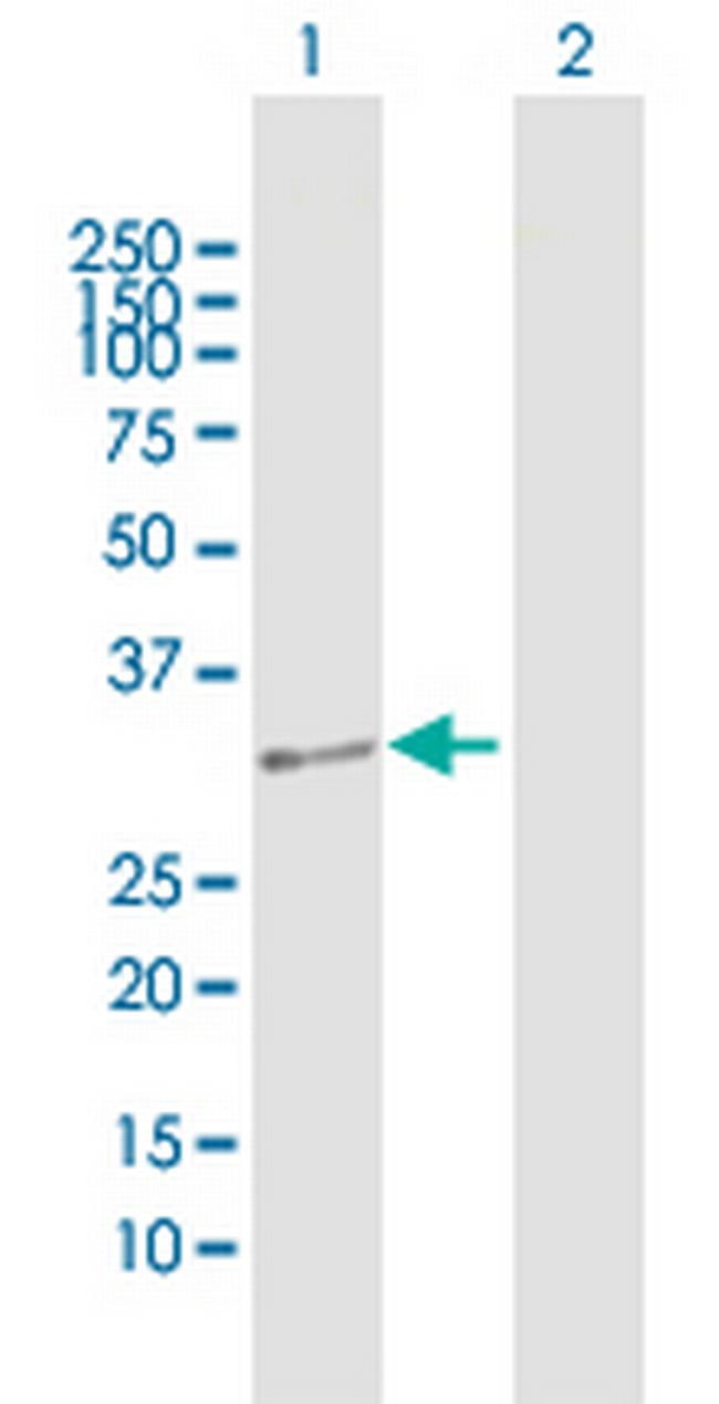 DUS4L Antibody in Western Blot (WB)