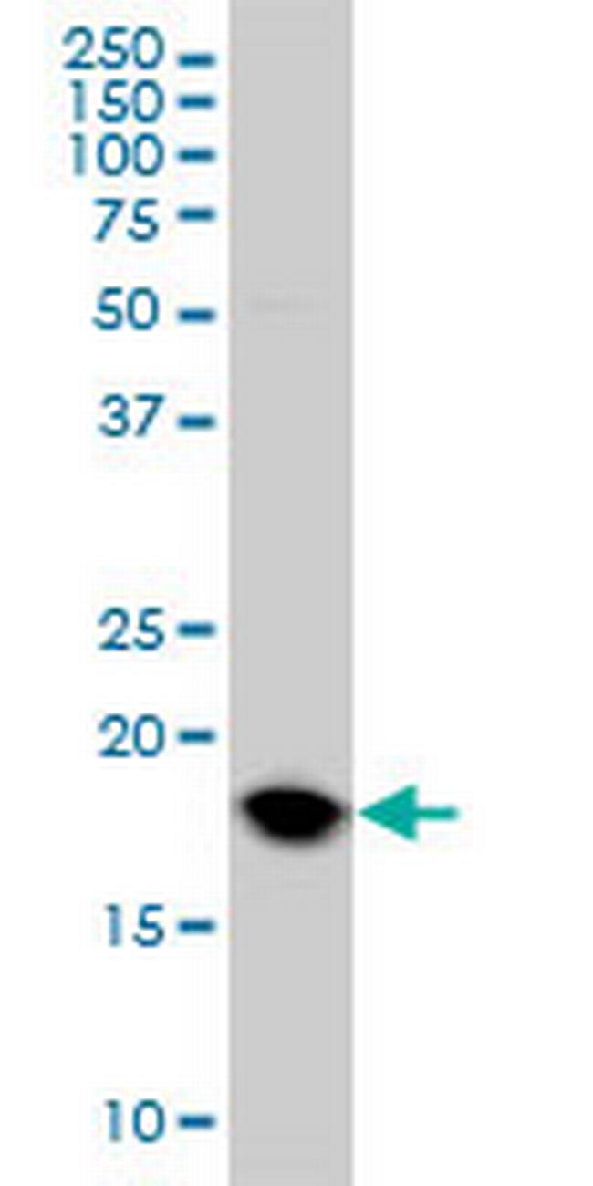 UBE2C Antibody in Western Blot (WB)