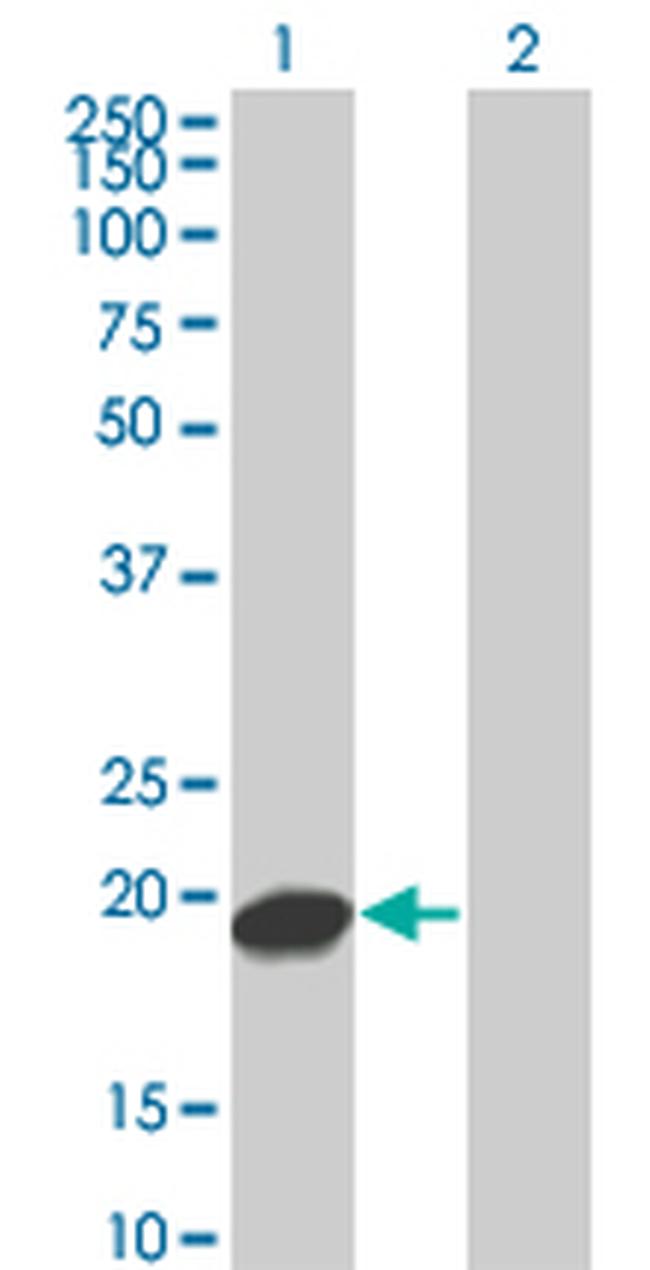 UBE2C Antibody in Western Blot (WB)