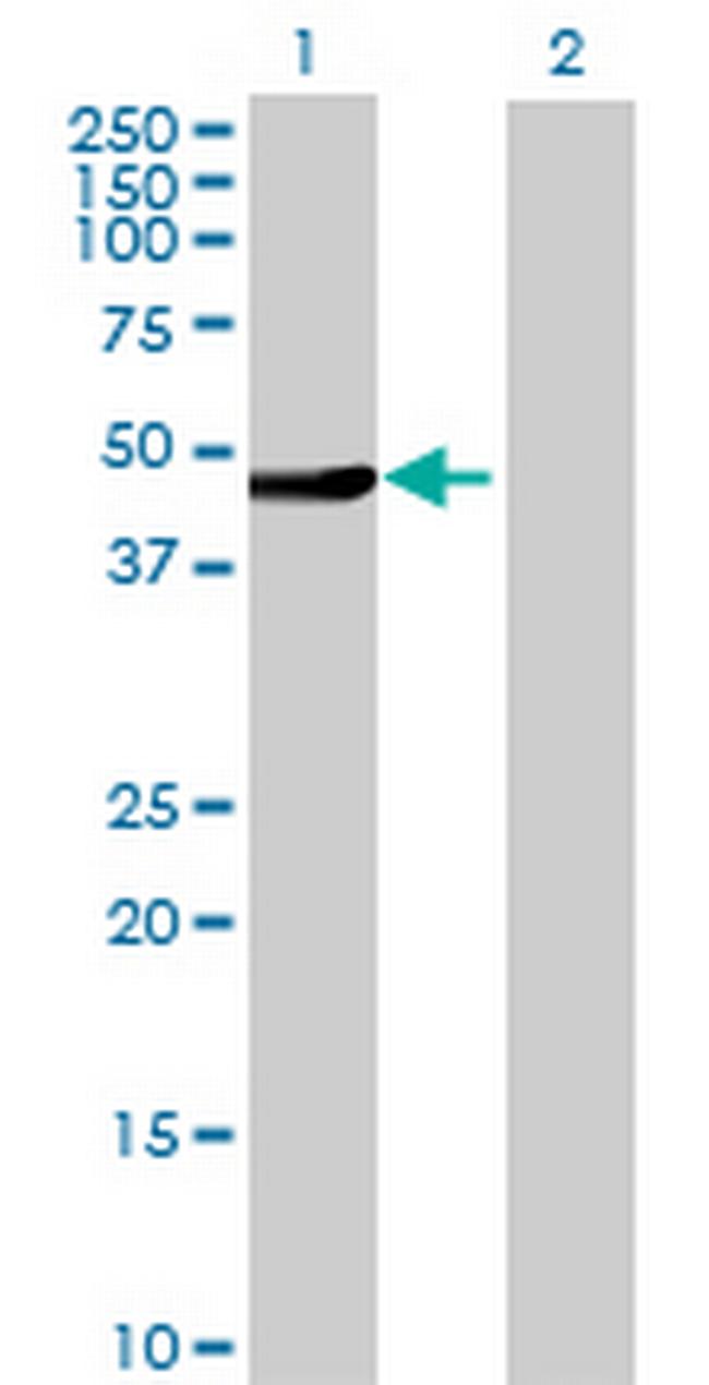 TRIM31 Antibody in Western Blot (WB)