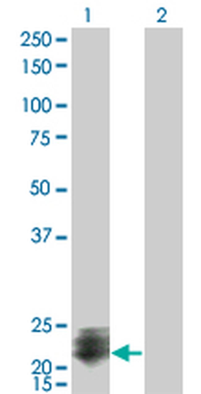 STMN2 Antibody in Western Blot (WB)