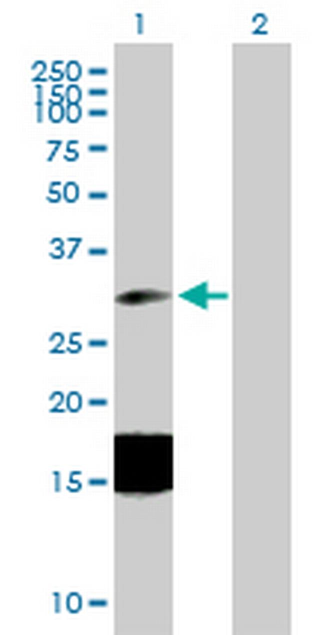 ESM1 Antibody in Western Blot (WB)