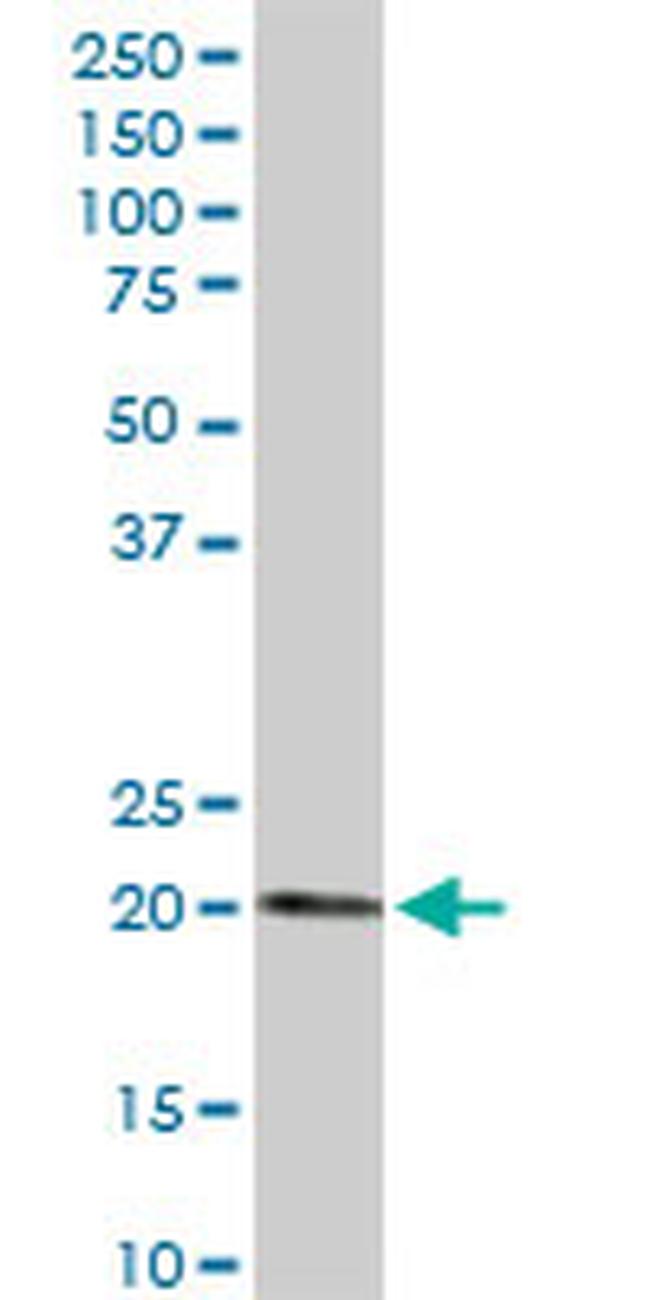 ESM1 Antibody in Western Blot (WB)