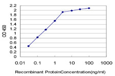 ESM1 Antibody in ELISA (ELISA)