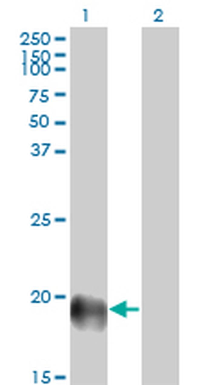 ESM1 Antibody in Western Blot (WB)