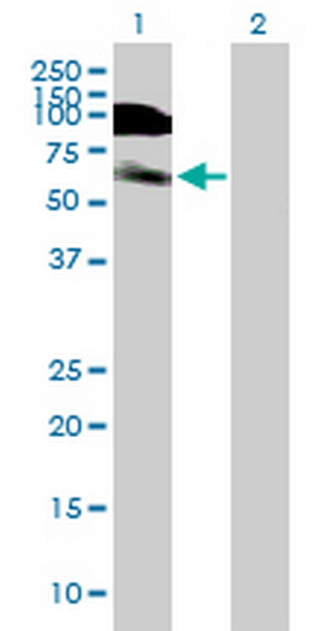 DIDO1 Antibody in Western Blot (WB)