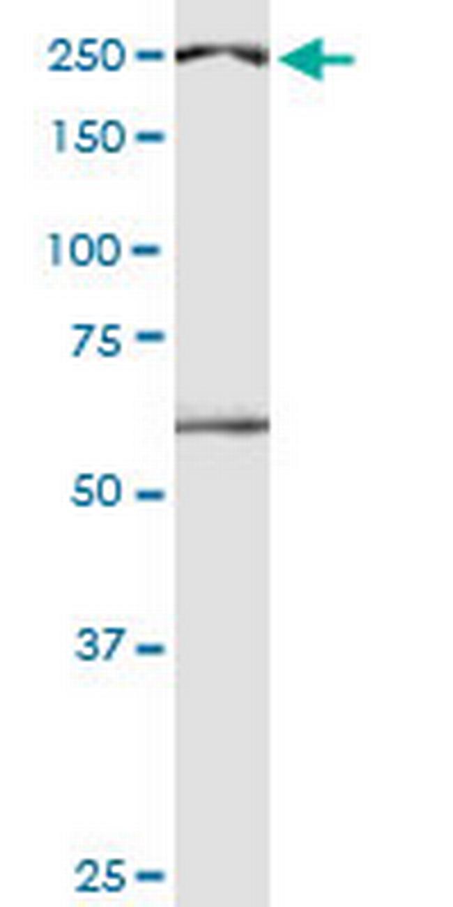 DIDO1 Antibody in Western Blot (WB)