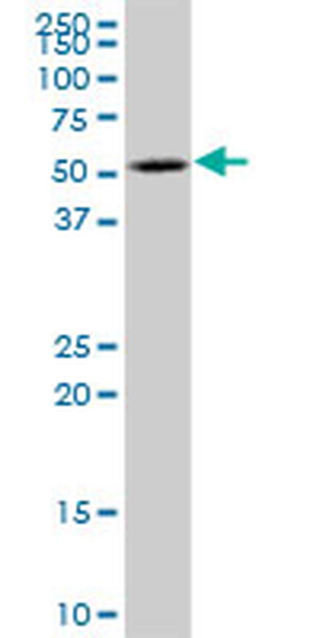 KATNA1 Antibody in Western Blot (WB)