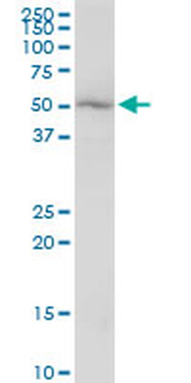 KATNA1 Antibody in Western Blot (WB)