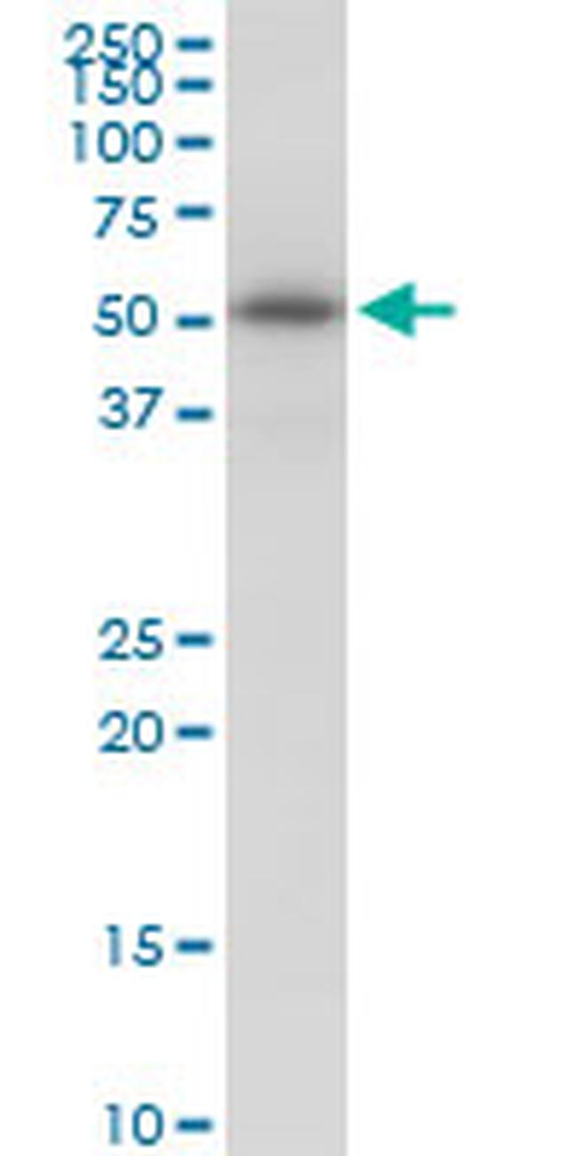 KATNA1 Antibody in Western Blot (WB)