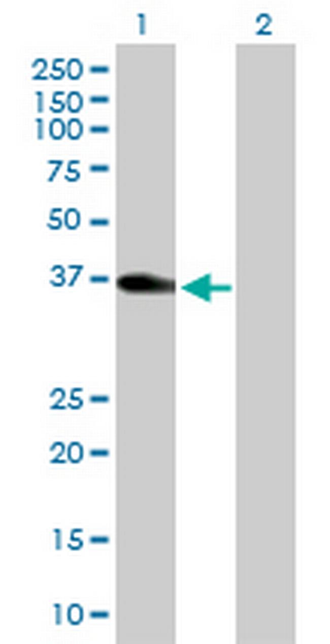 KATNA1 Antibody in Western Blot (WB)