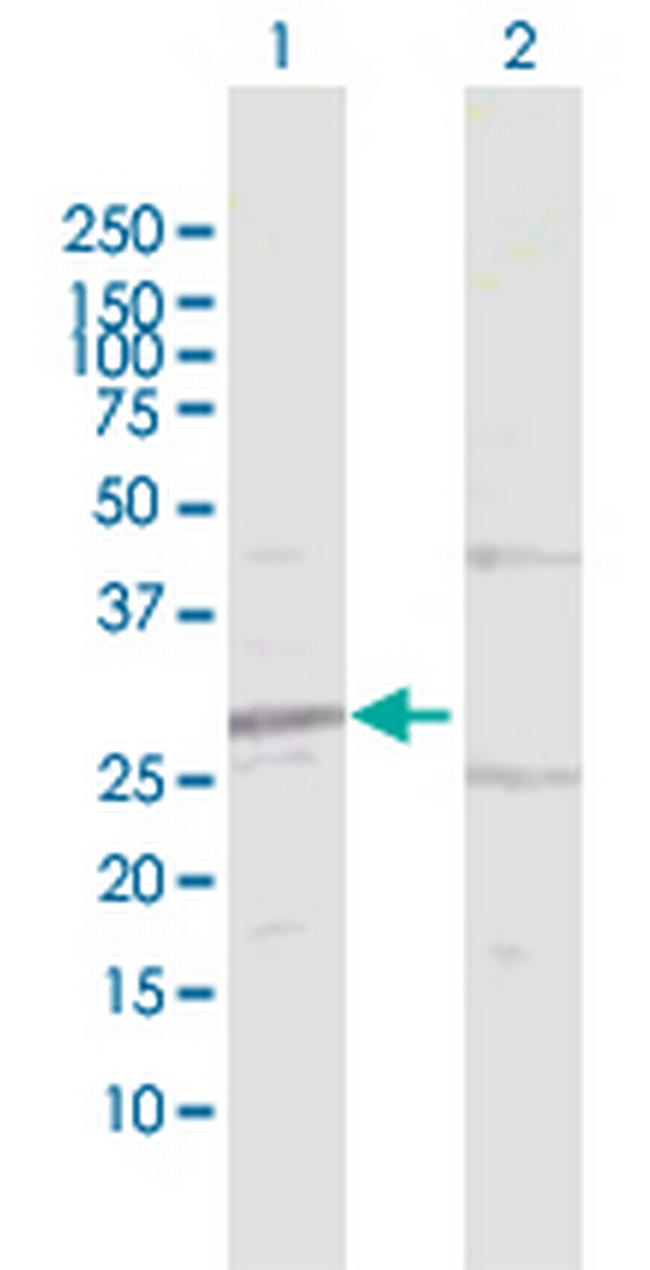 HIBADH Antibody in Western Blot (WB)