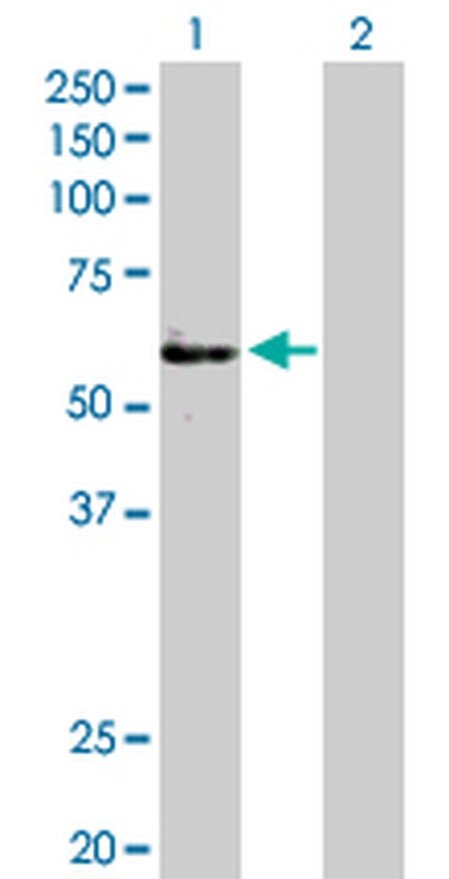 FGFR1OP Antibody in Western Blot (WB)