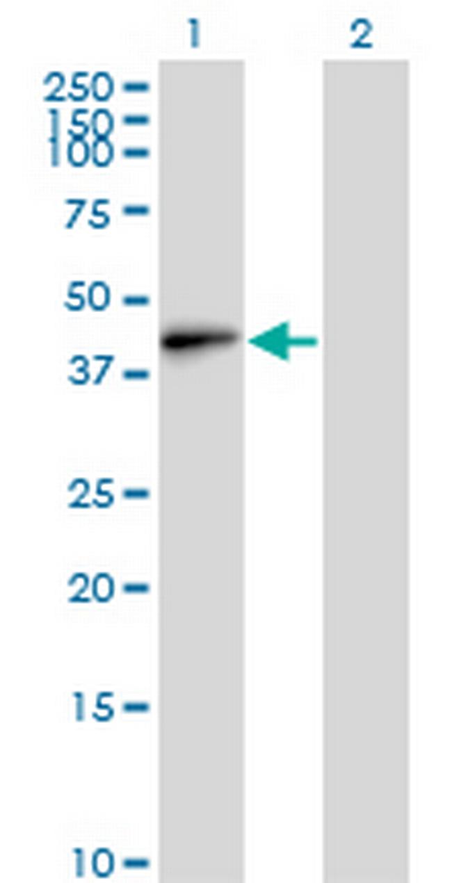 EMILIN1 Antibody in Western Blot (WB)