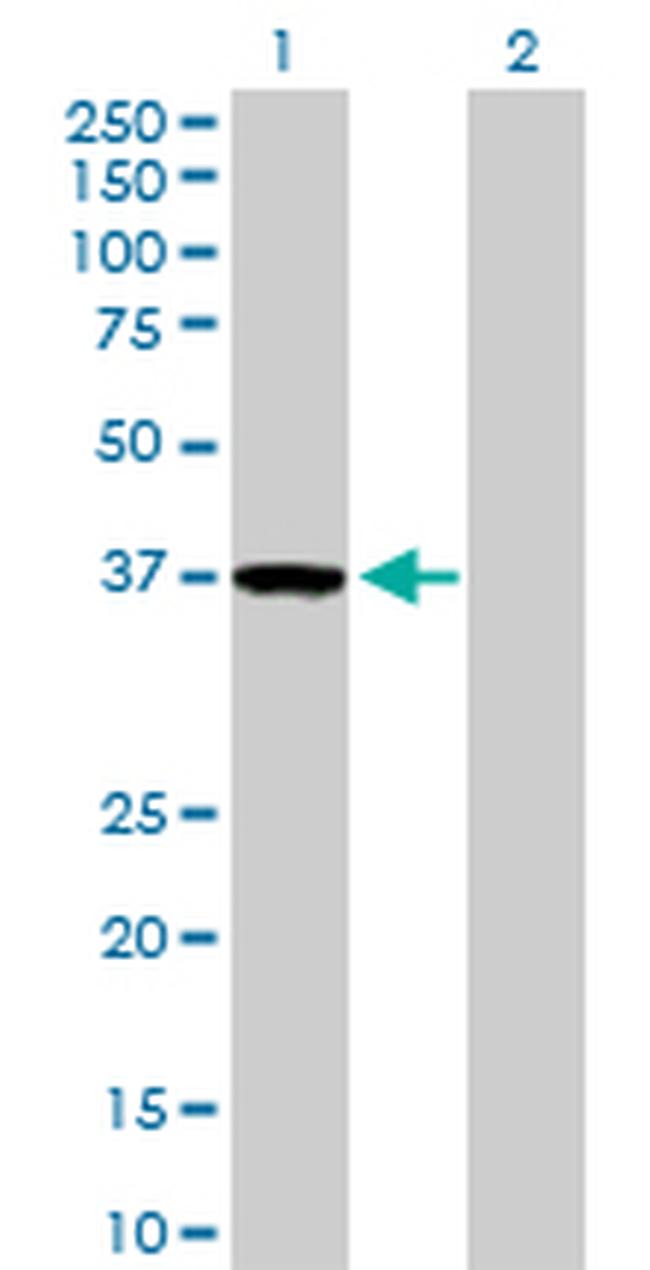 ZWINT Antibody in Western Blot (WB)