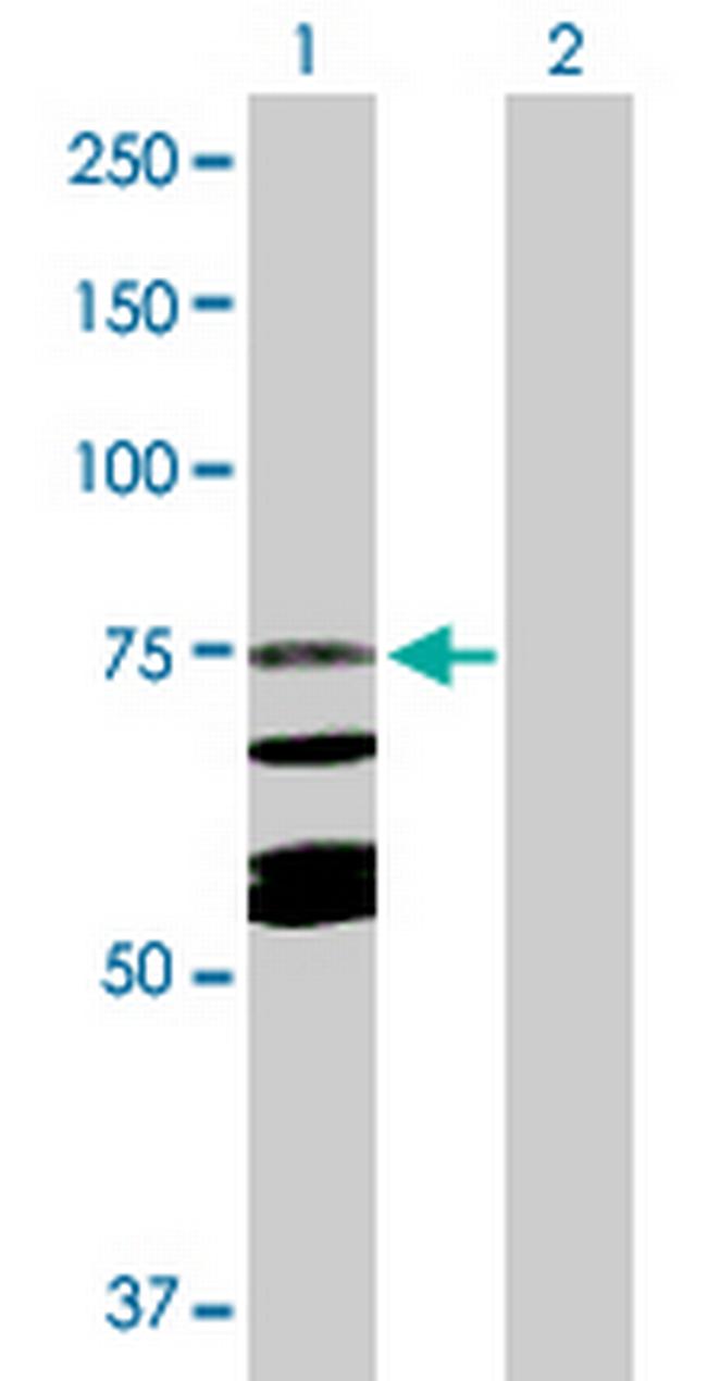 CAPN10 Antibody in Western Blot (WB)