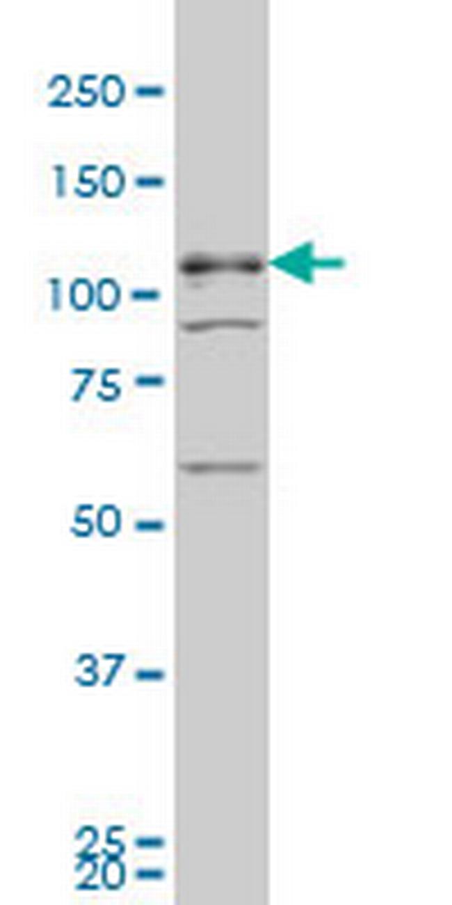TBC1D8 Antibody in Western Blot (WB)