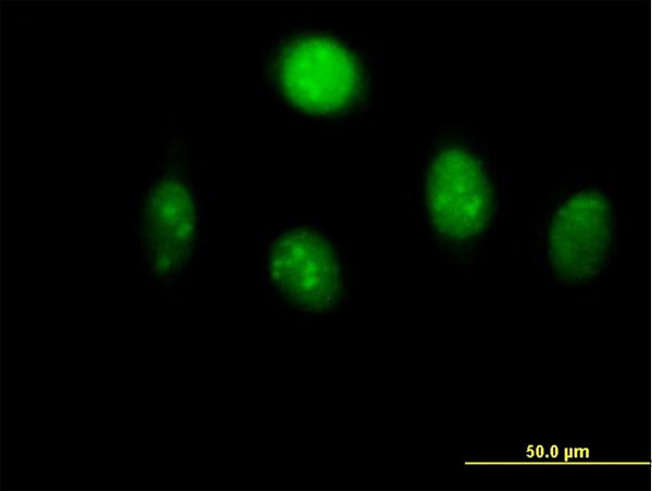 MYST2 Antibody in Immunocytochemistry (ICC/IF)