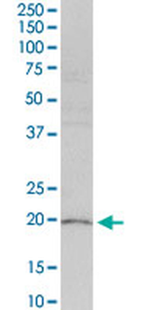 HRASLS3 Antibody in Western Blot (WB)