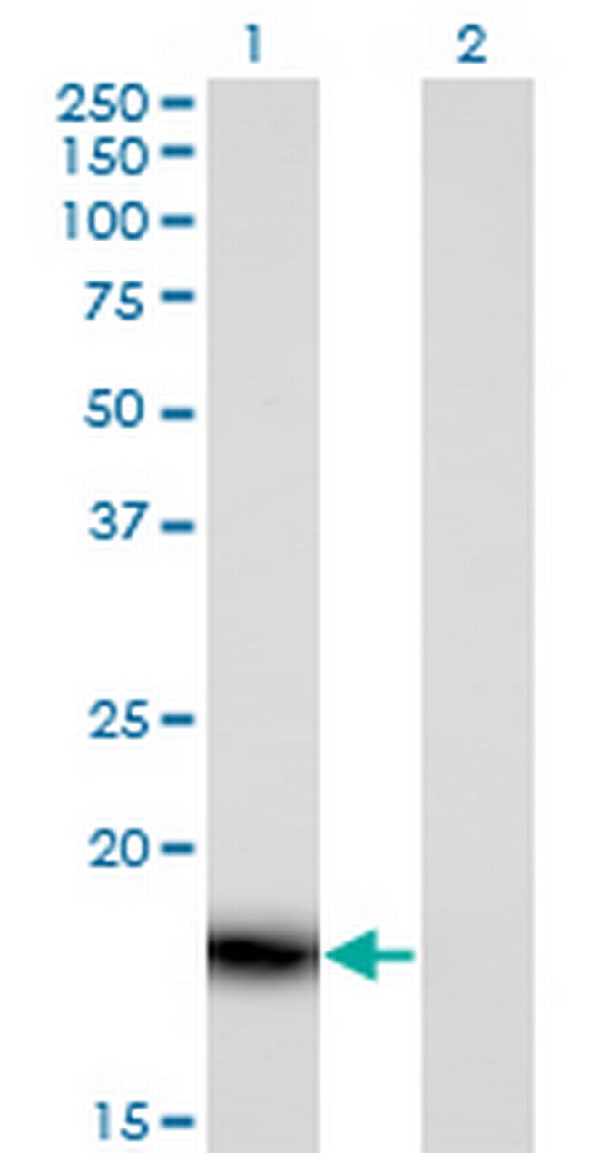 PLA2G16 Antibody in Western Blot (WB)