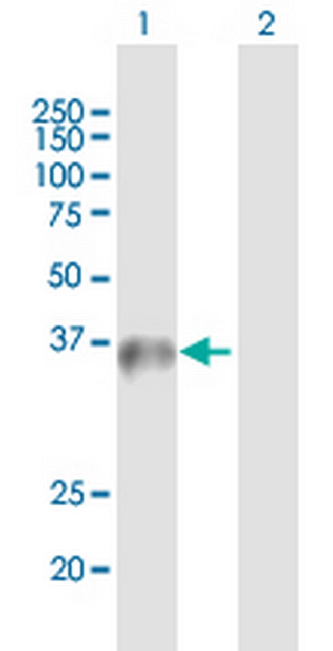 WDR45 Antibody in Western Blot (WB)