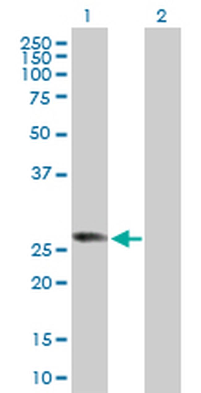 RABL2B Antibody in Western Blot (WB)