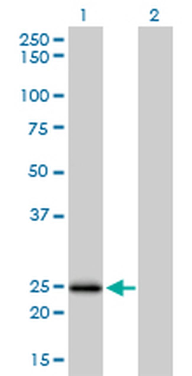 NUDT5 Antibody in Western Blot (WB)