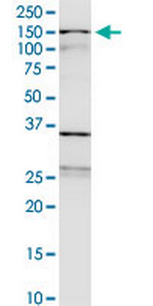 WDHD1 Antibody in Western Blot (WB)