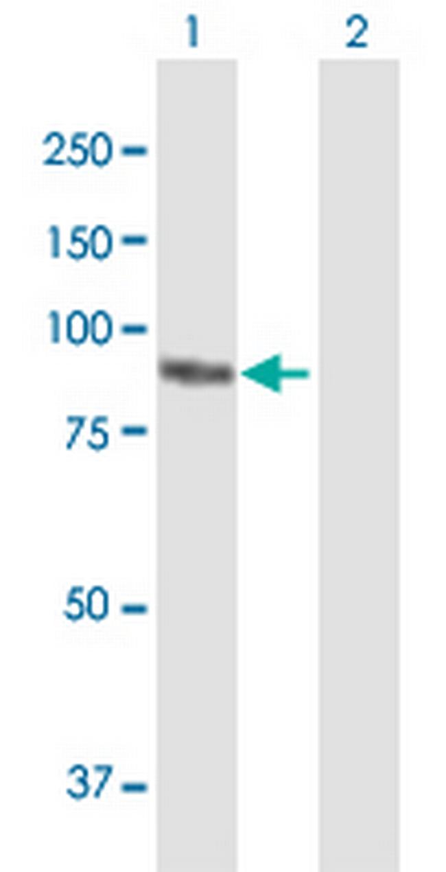 PKP3 Antibody in Western Blot (WB)