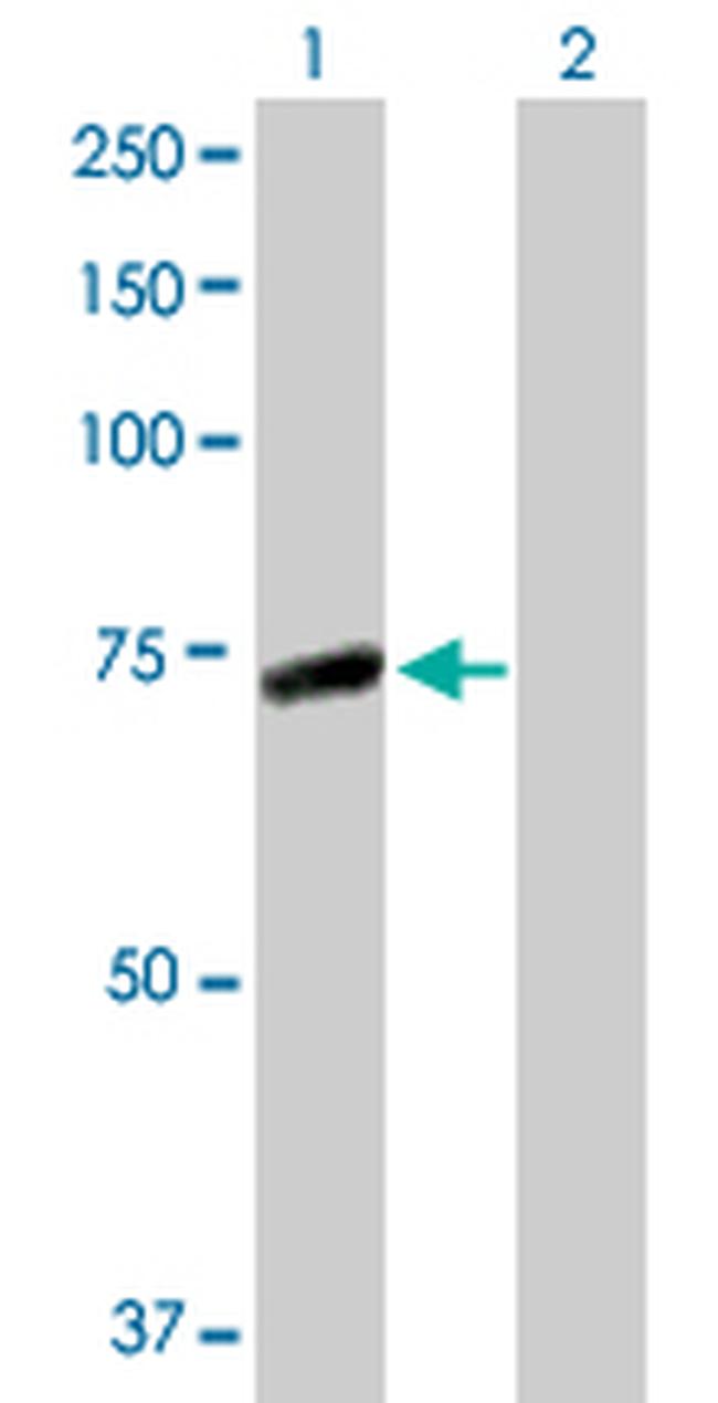 IRAK3 Antibody in Western Blot (WB)