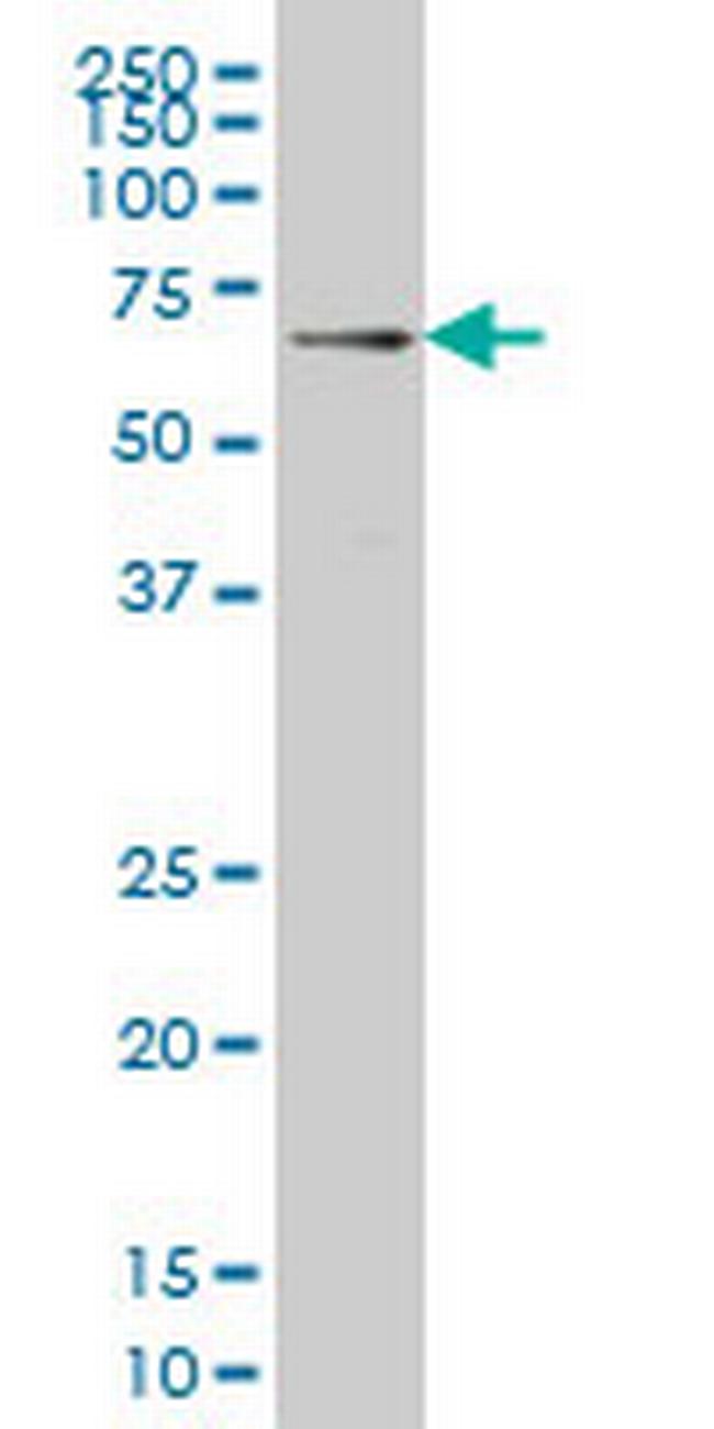 IRAK3 Antibody in Western Blot (WB)