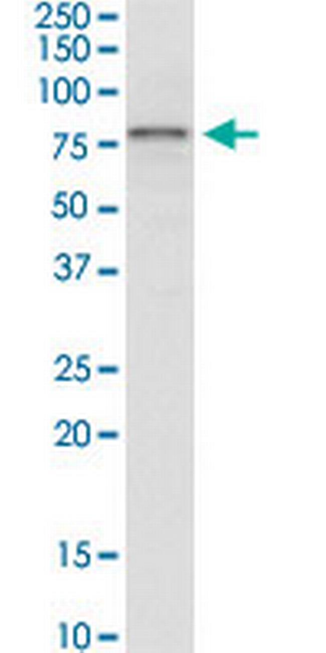 IRAK3 Antibody in Western Blot (WB)