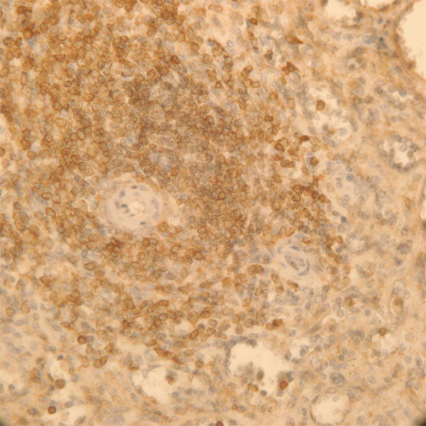 AKAP13 Antibody in Immunohistochemistry (Paraffin) (IHC (P))