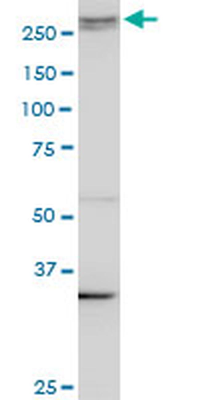 AKAP13 Antibody in Western Blot (WB)