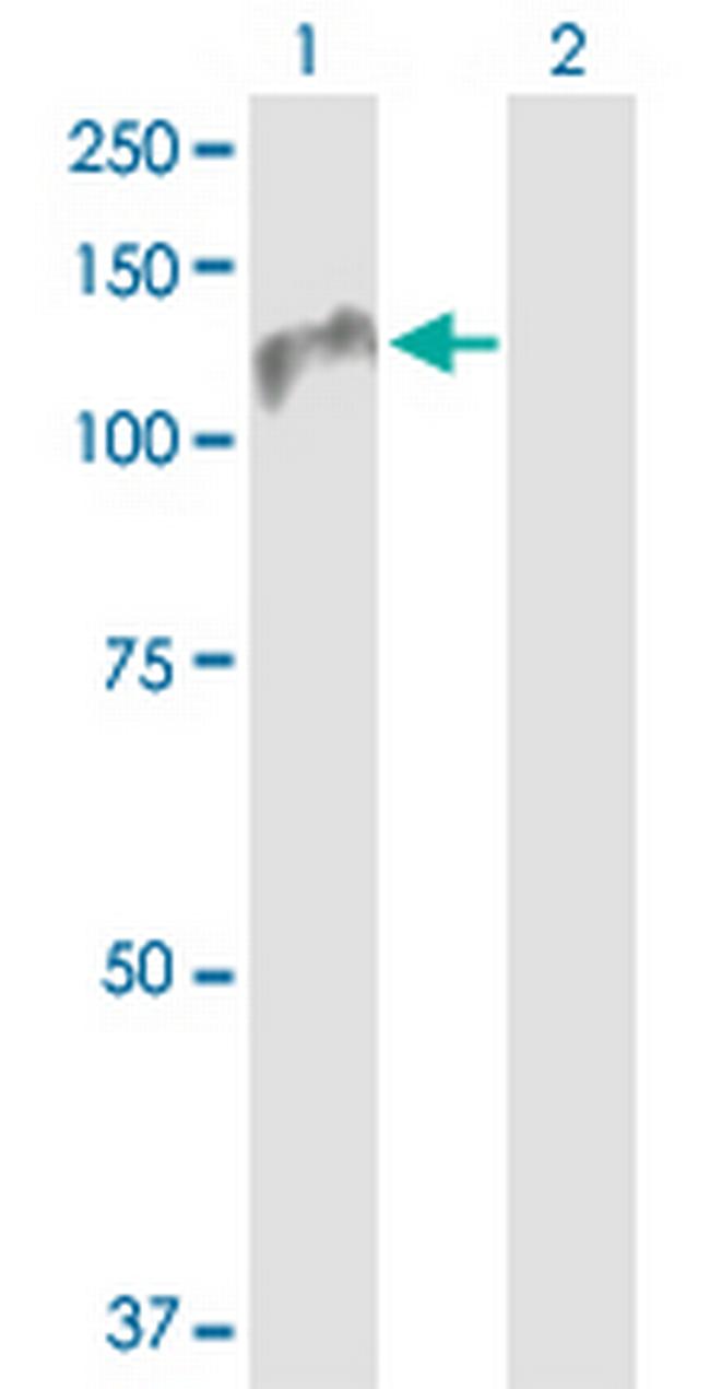 ZHX1 Antibody in Western Blot (WB)