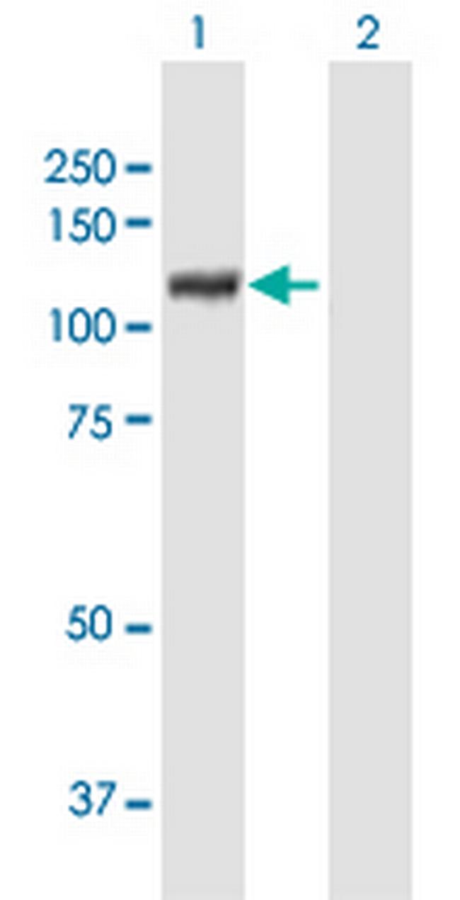 XPOT Antibody in Western Blot (WB)