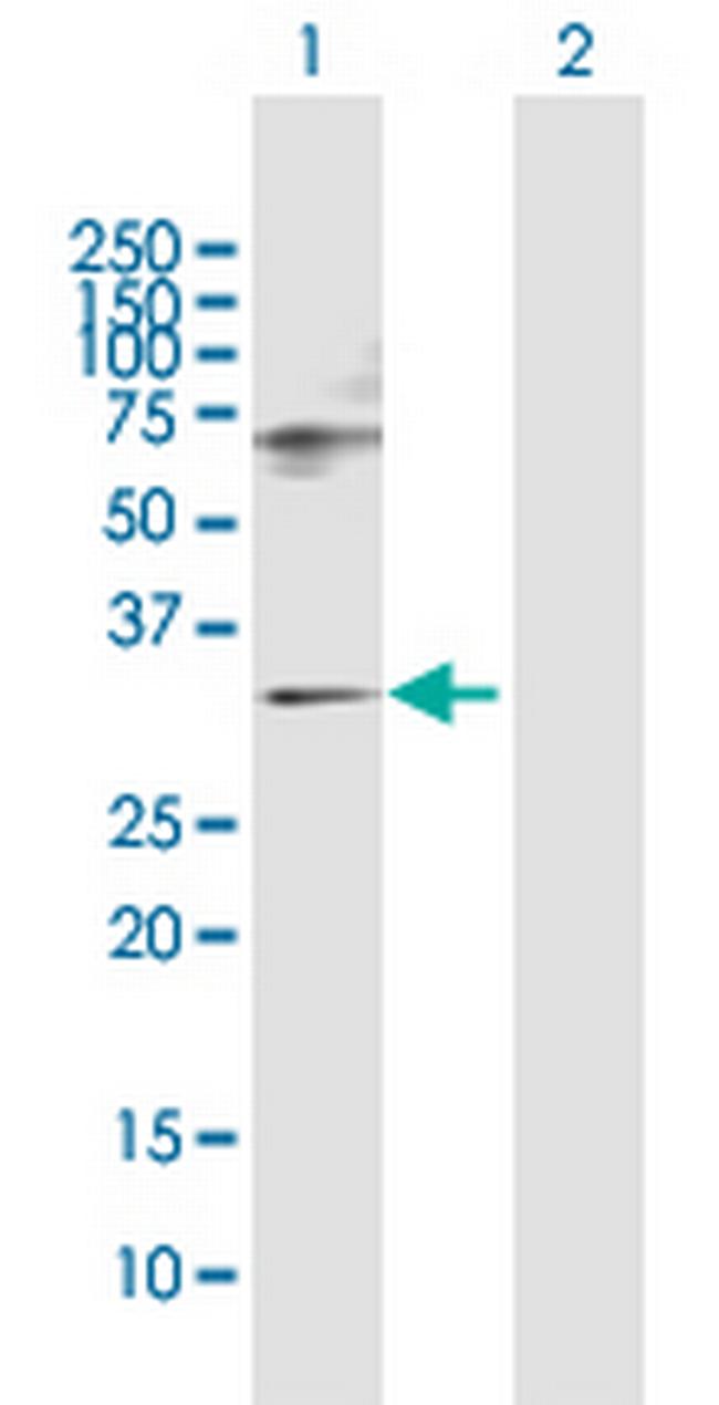 SNF8 Antibody in Western Blot (WB)