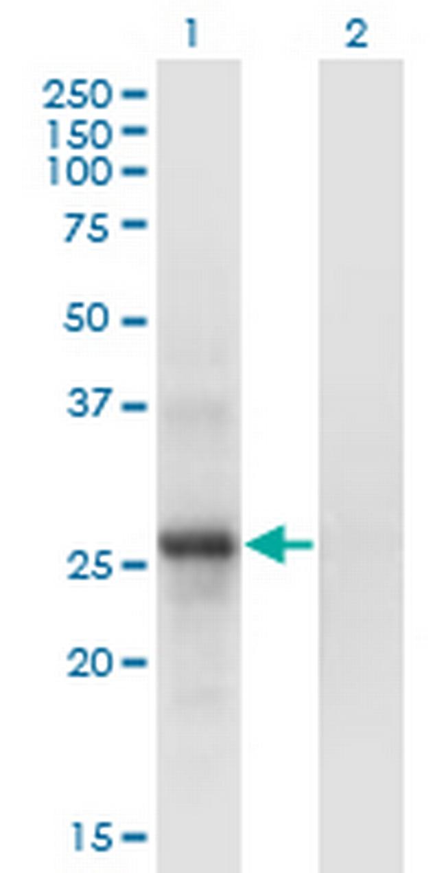 SNF8 Antibody in Western Blot (WB)