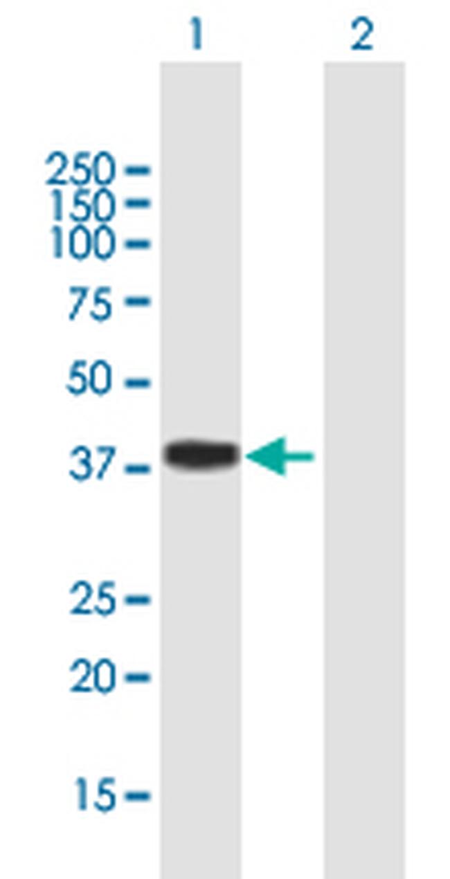 TREX1 Antibody in Western Blot (WB)