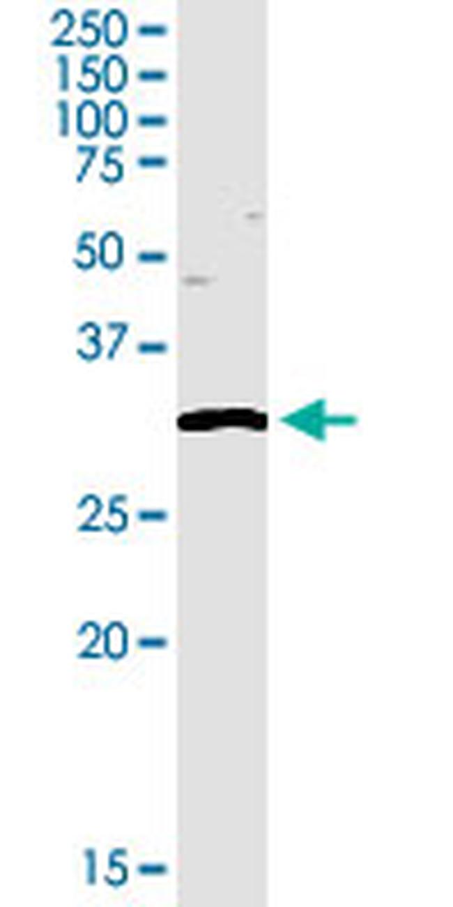 TREX1 Antibody in Western Blot (WB)