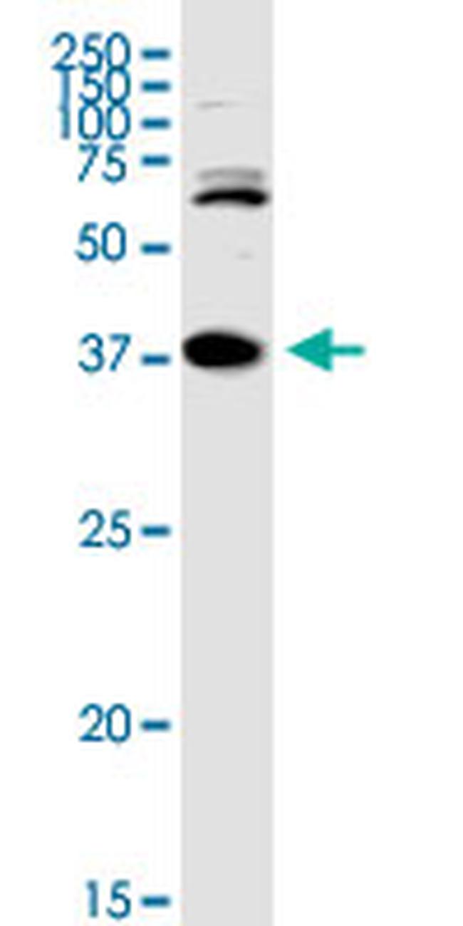 TREX1 Antibody in Western Blot (WB)