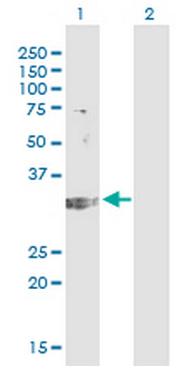 TREX1 Antibody in Western Blot (WB)