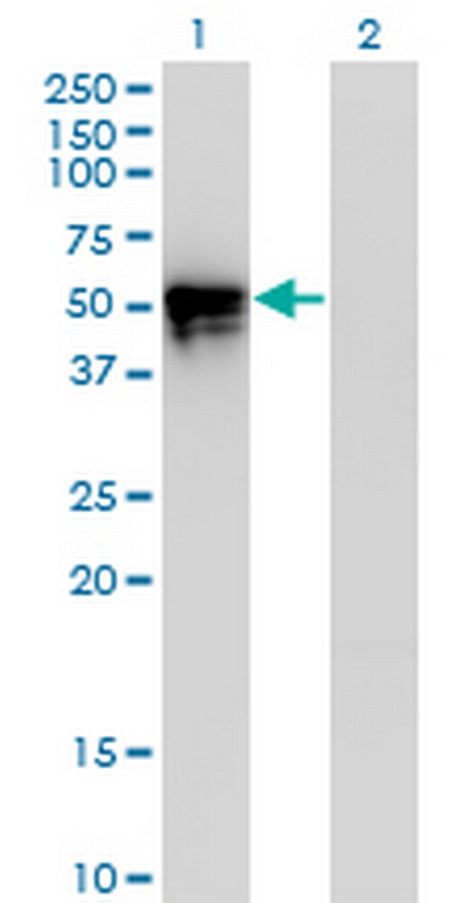 KLF8 Antibody in Western Blot (WB)