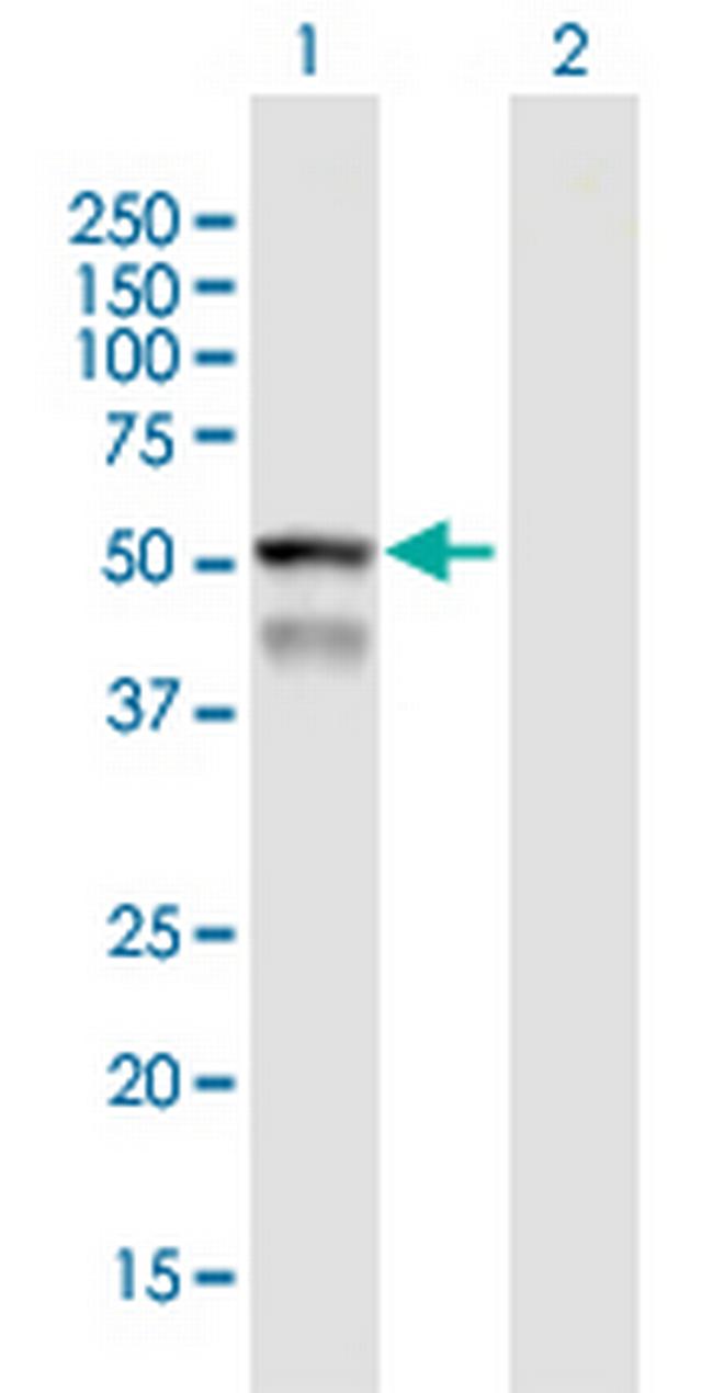 CYP4F8 Antibody in Western Blot (WB)