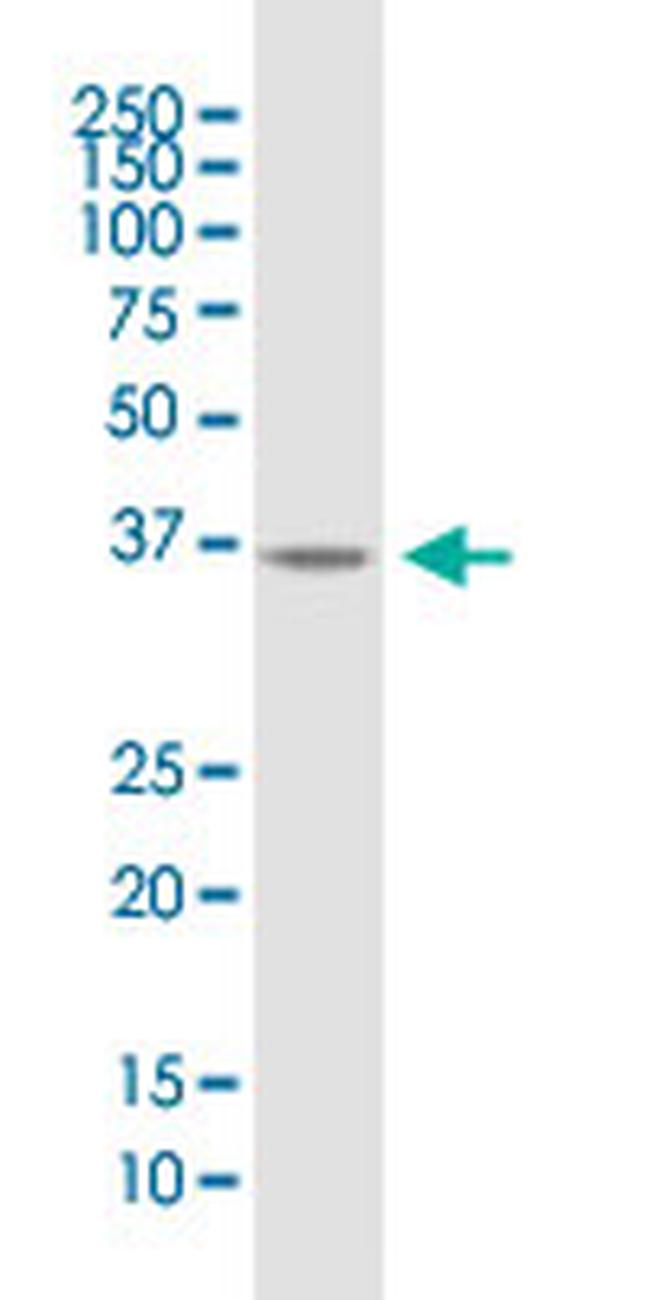 B4GALT7 Antibody in Western Blot (WB)