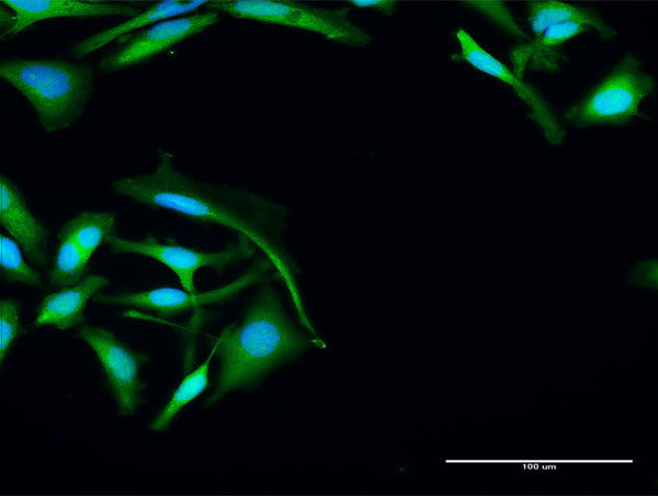 PARK7 Antibody in Immunocytochemistry (ICC/IF)