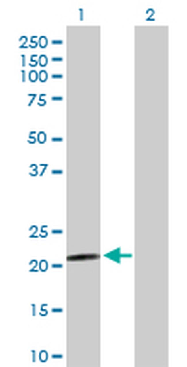 PARK7 Antibody in Western Blot (WB)