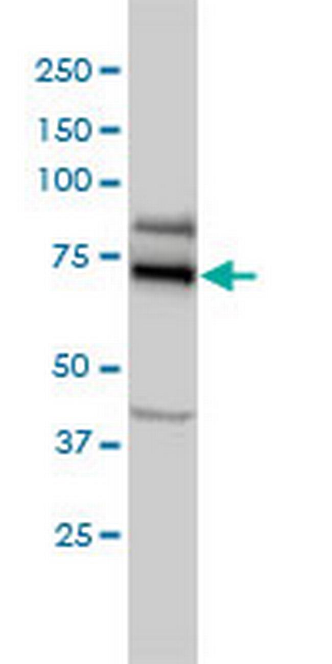 HSGT1 Antibody in Western Blot (WB)