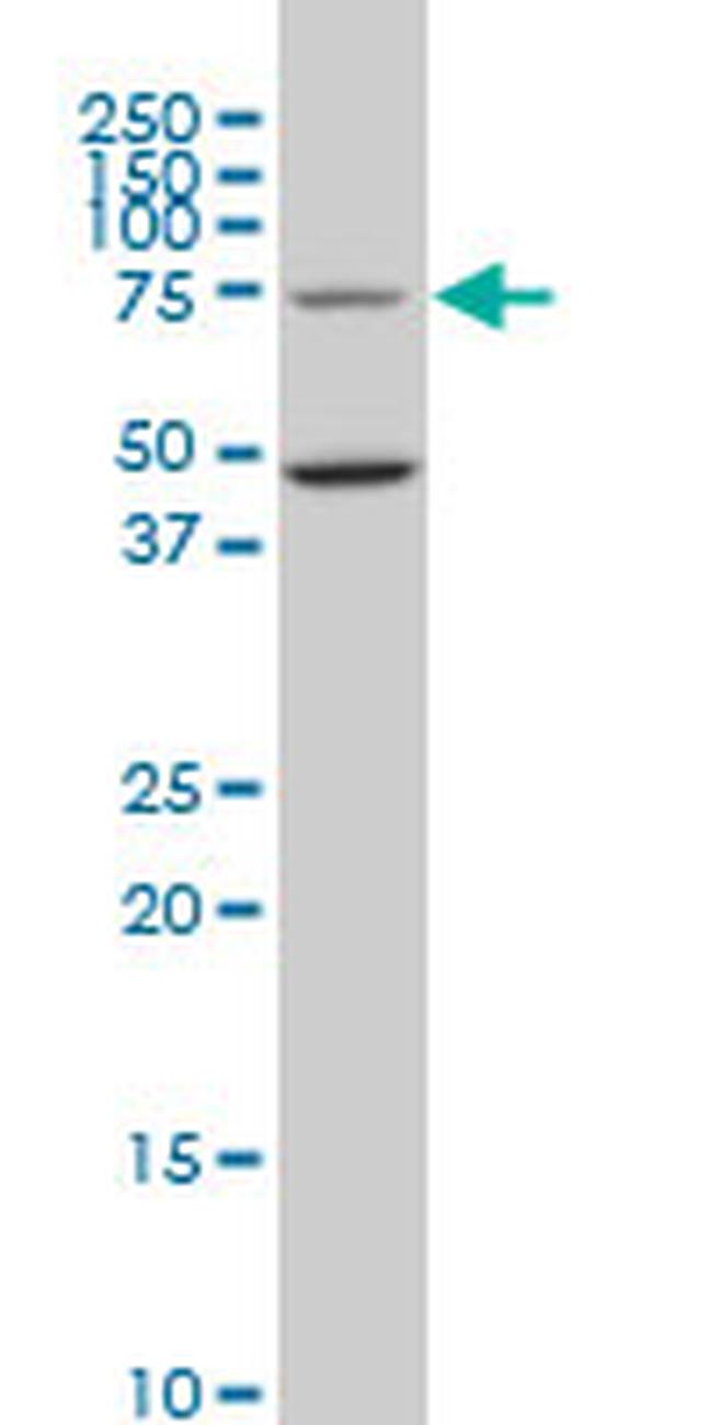 HSGT1 Antibody in Western Blot (WB)