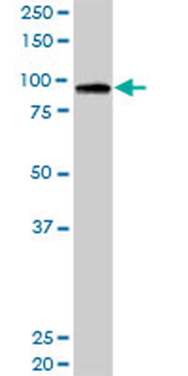 RASA3 Antibody in Western Blot (WB)